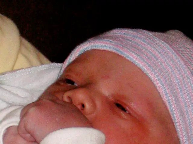 Goldenhar Syndrome Symptoms, Origins, and Prognosis: Exploring its Manifestations, Causes, and...