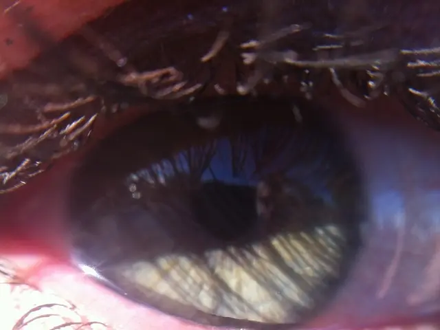 Challenges encountered by ignoring dry eye condition